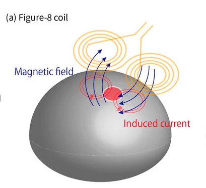This shows how the magnetic field from a figure 8 coil targets the brain at NeoPsych in Glendale, CA
